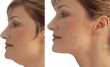 Loose-Skin-Tighten-Loose-Skin-Loose-Neck-Skin-Skin-On-Neck-Neck-Naturally-Neck-Exercises-Skin-On-Face-Extra-Skin-Neck-Skin-Exercises-Neck-Skin-Exercises-Marks-On-Skin-Get-Tighter-Neck